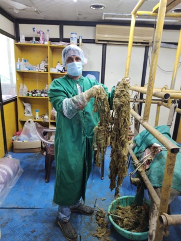 Plastic Removal